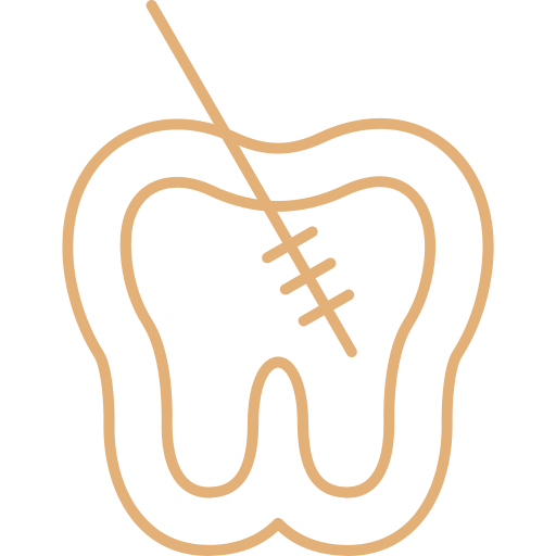 Endodoncia