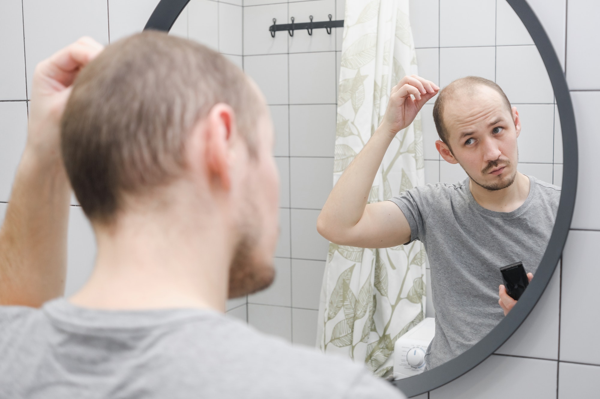 Recupera tu autoestima y renueva tu imagen personal con los tratamientos para la alopecia de la Clínica Medical Beauty Carballo.