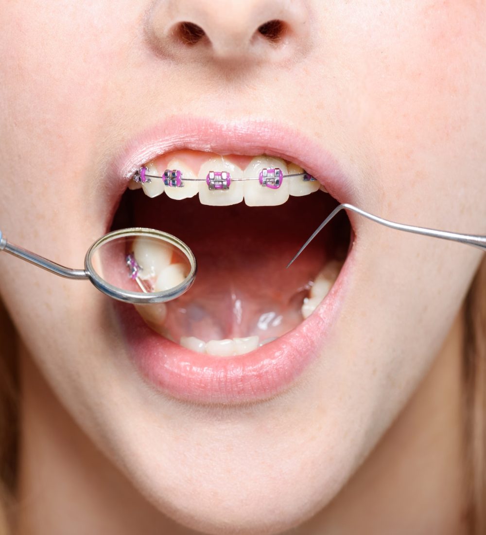 Cropped shot of dentist in latex gloves using a mouth mirror and periodontal probe on woman with